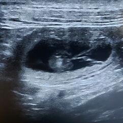 Ultraschallaufnahme 28. Trächtigkeitstag